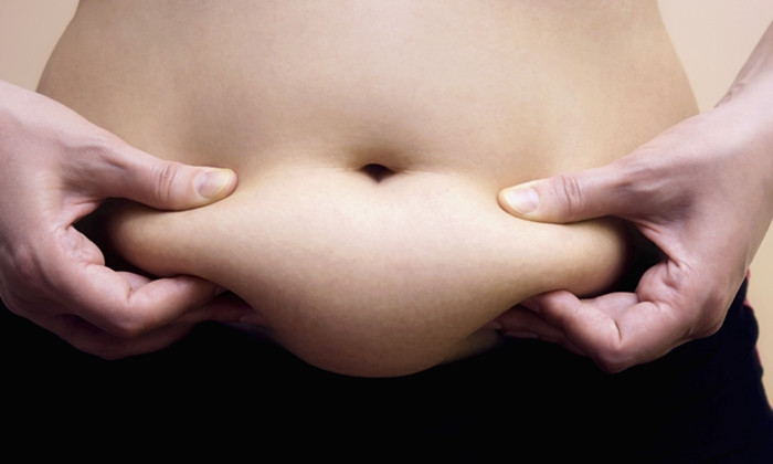 Obese women shows fat on her stomach, Photography
